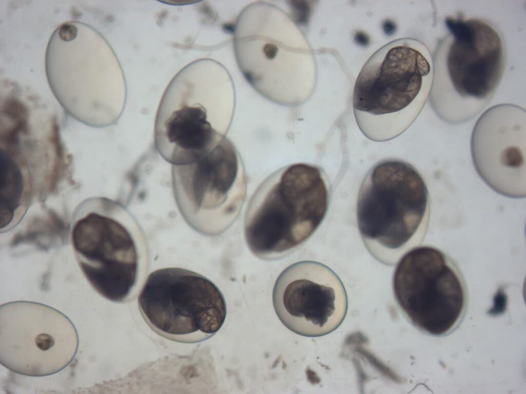 This is a glorious sight of several freshwater pond snails in various embryonic stages. Every single one of those beautifully transparent egg capsules allow for the observation of growing embryos, while also acting as diffusion barriers that prevent the passage of large molecules. In other words, they do a swell job of keeping the embryos within nourished and safe. (As seen under a stereo microscope.)